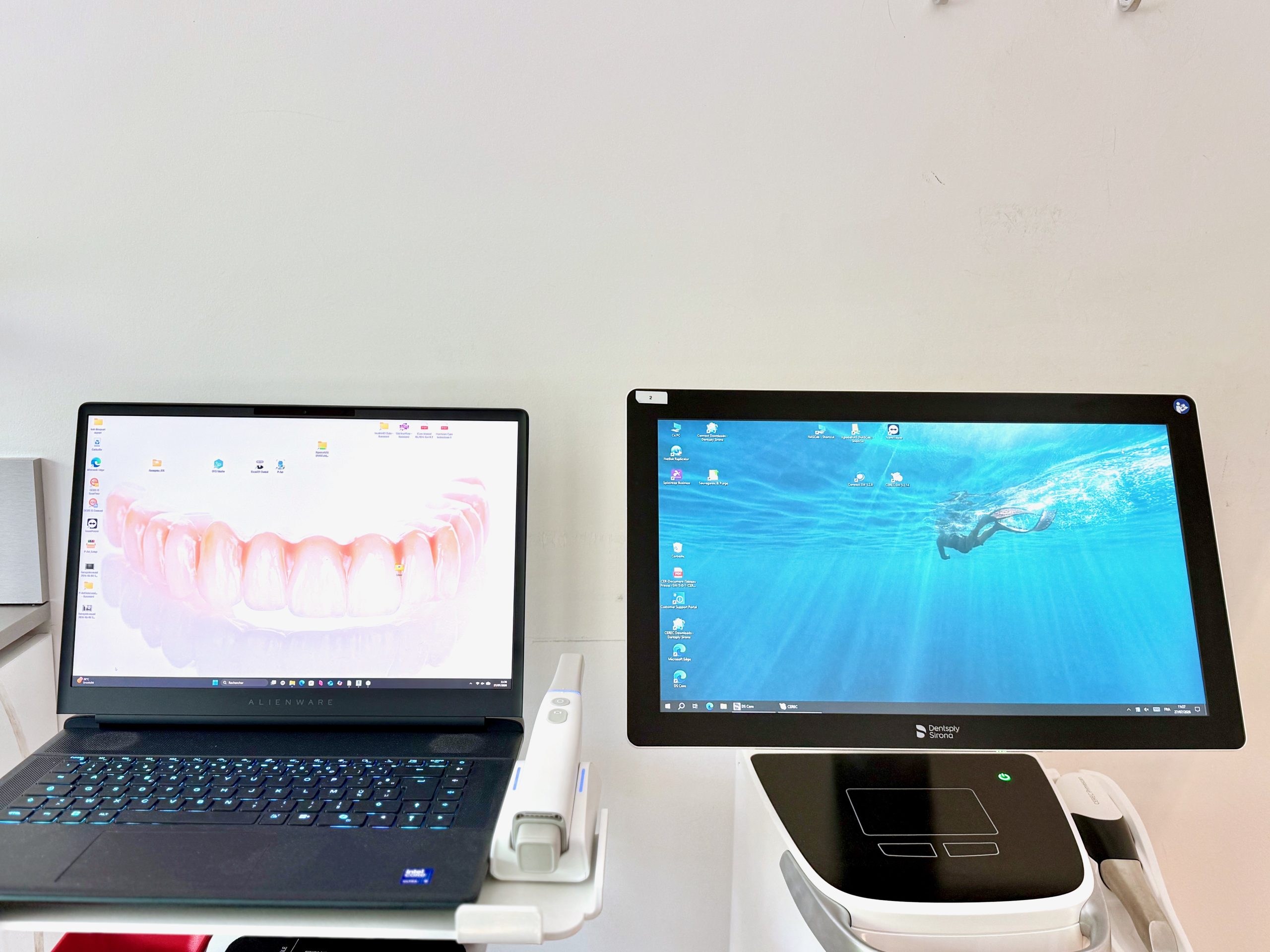 Caméra 3D pour empreinte numérique au Cabinet Sainte-Victoire, Aix-en-Provence
